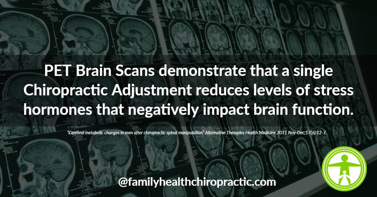 Chiropractic Impacts Brain Function