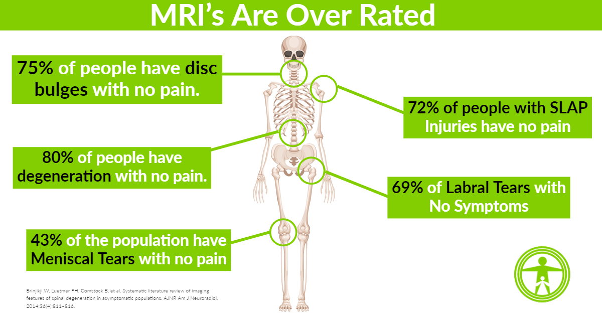 MRI are useless