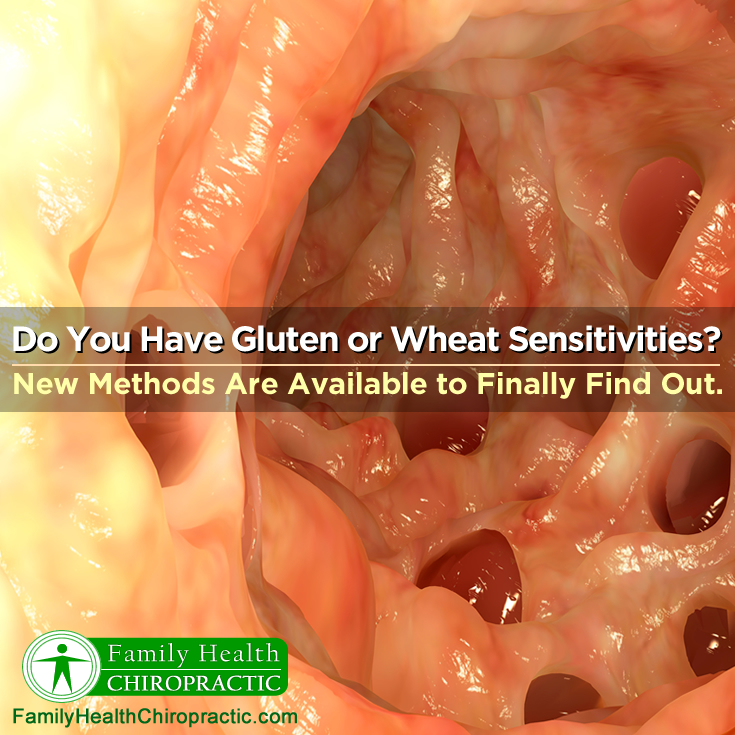 Are you gluten sensitive