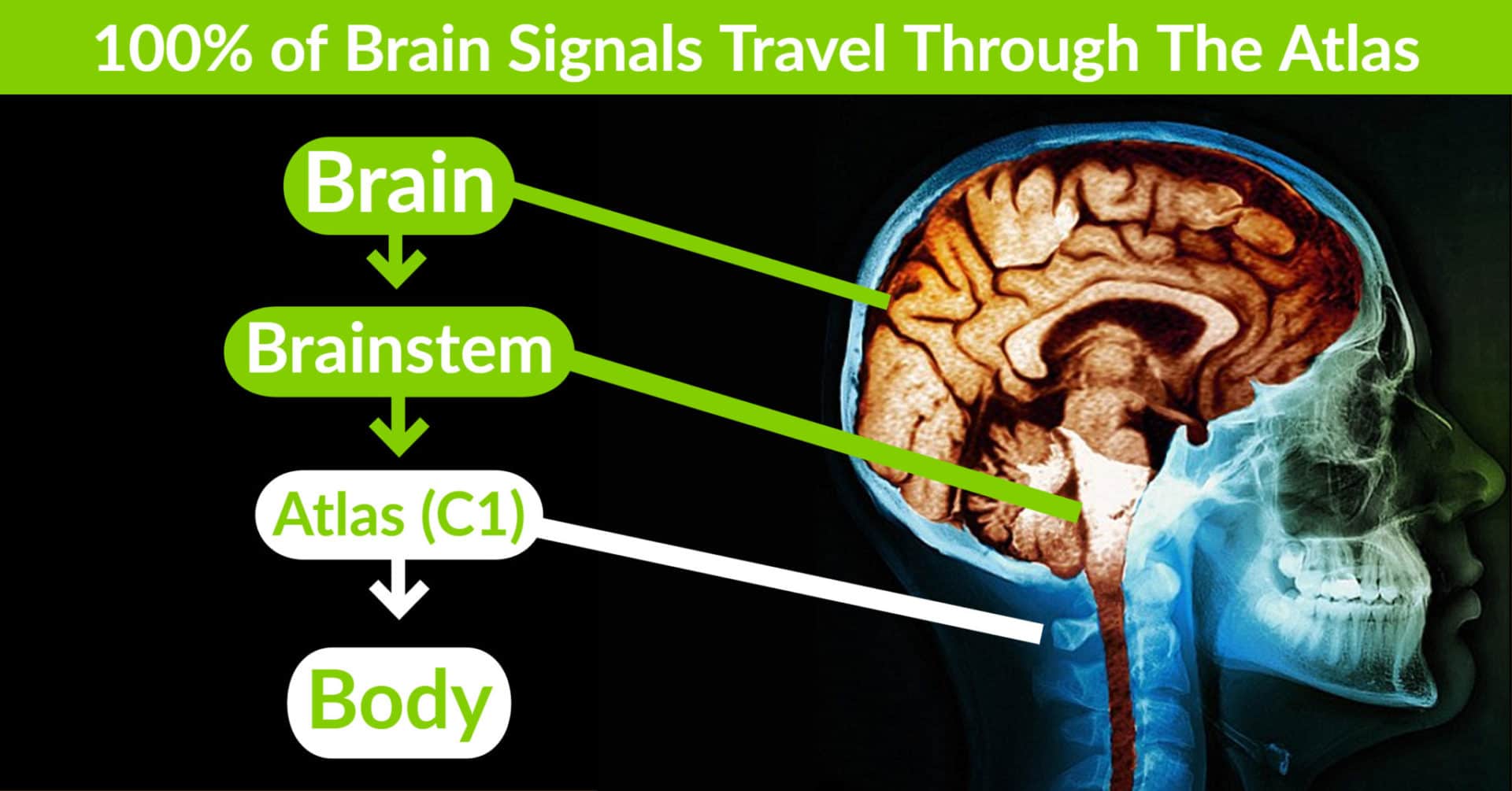 Brain and atlas bone