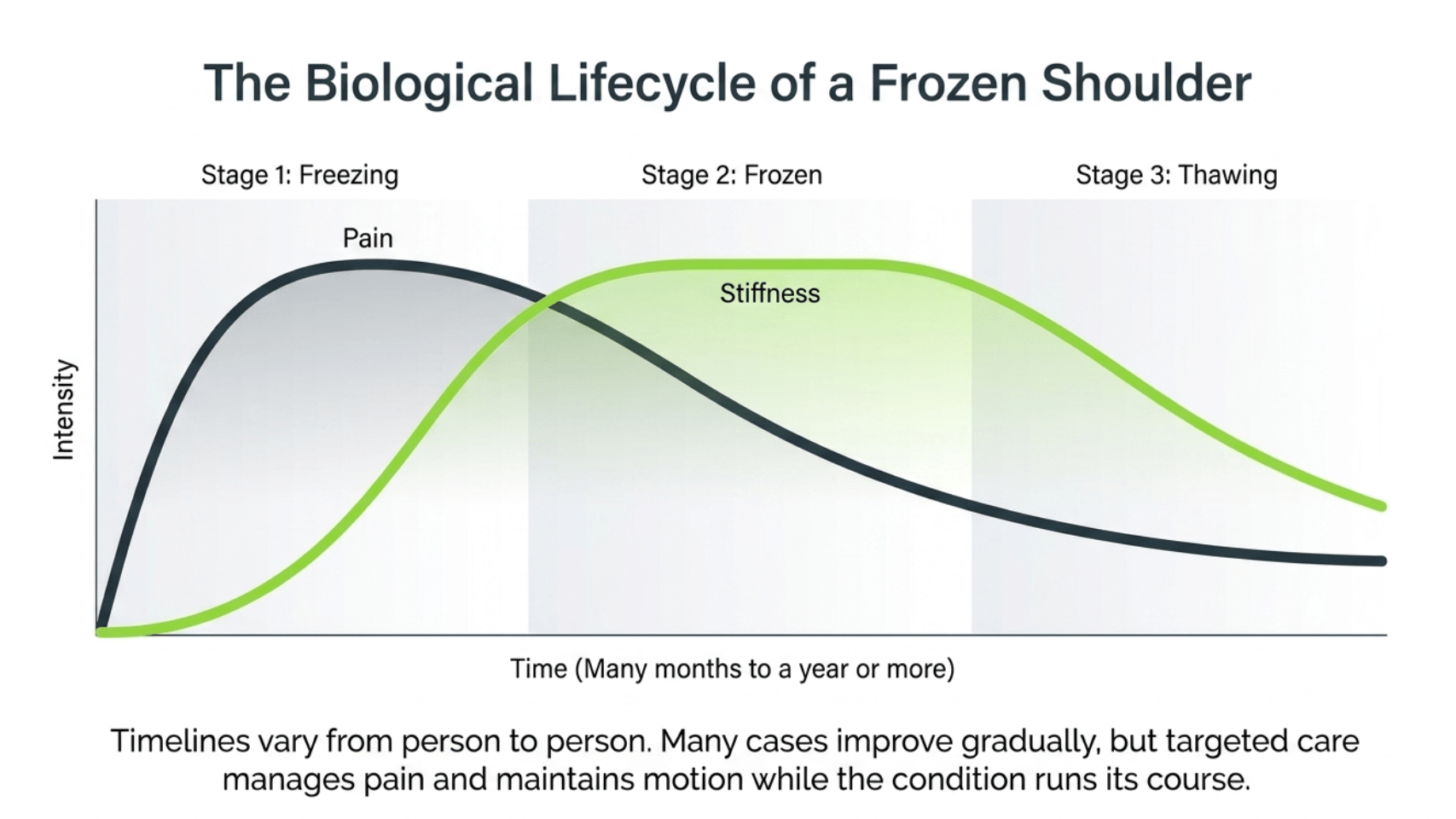 The biological lifecycle of a frozen shoulder across three stages: freezing, frozen, and thawing, showing how pain and stiffness change over many months to a year or more