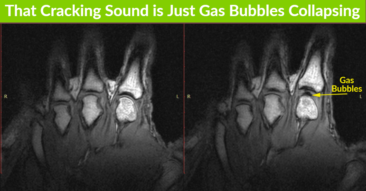 Gas bubbles back cracking