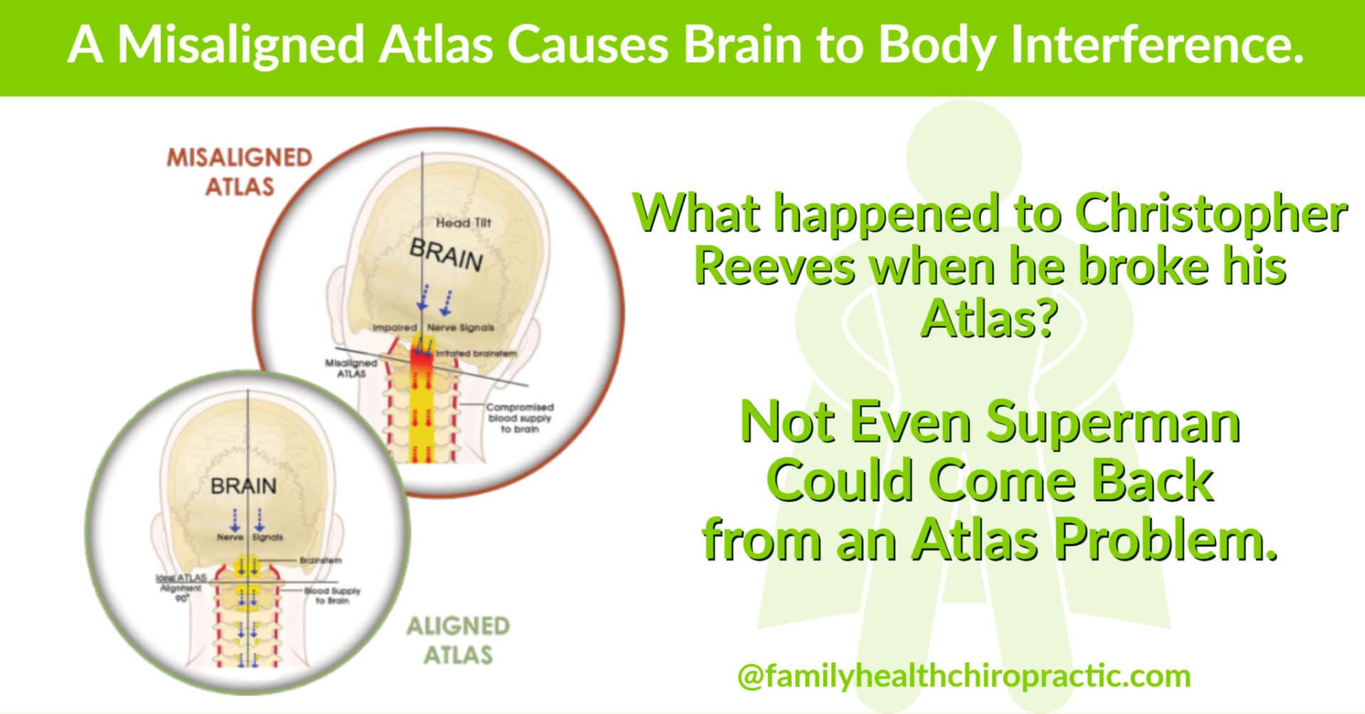 Misaligned atlas