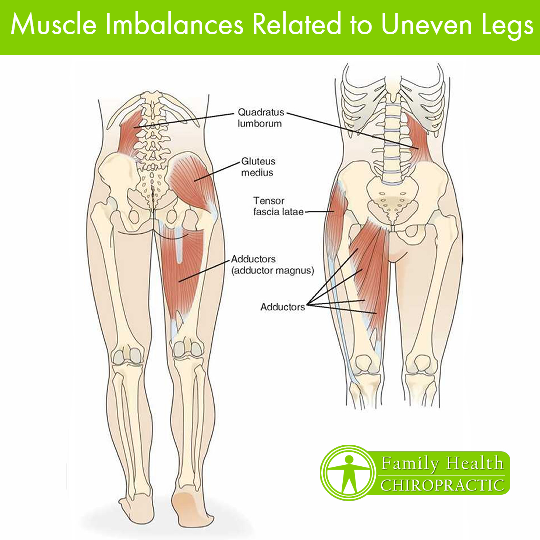 Muscle imbalances uneven legs