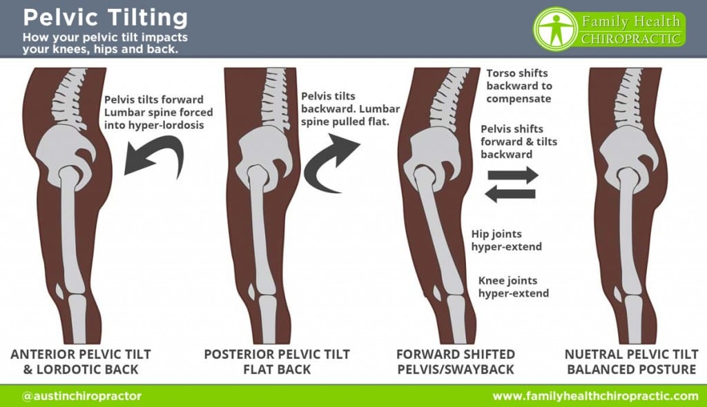 Pelvic tilt 1024x590