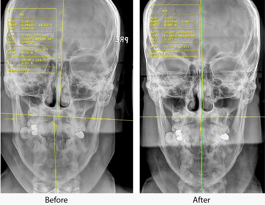 xrays performed by a chiropractor