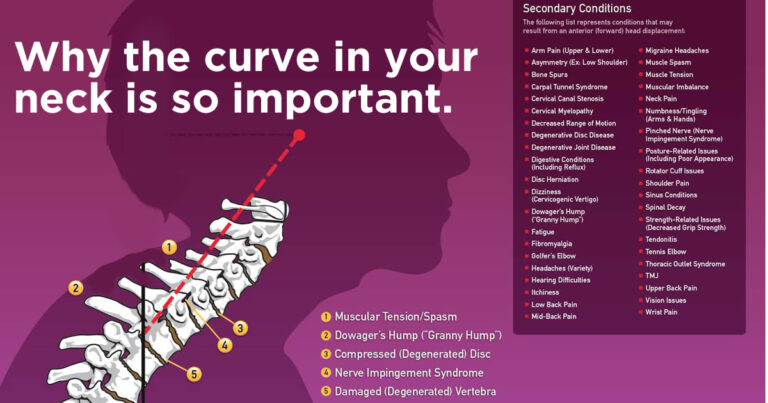 Why the curve is so important