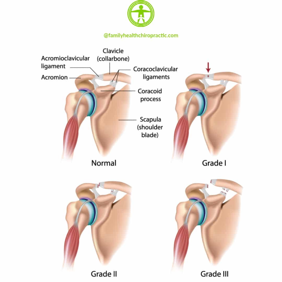 AC shoulder joint pain