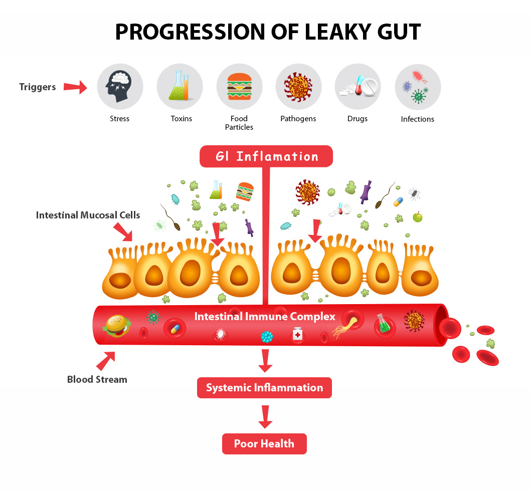 causes-of-leaky-gut