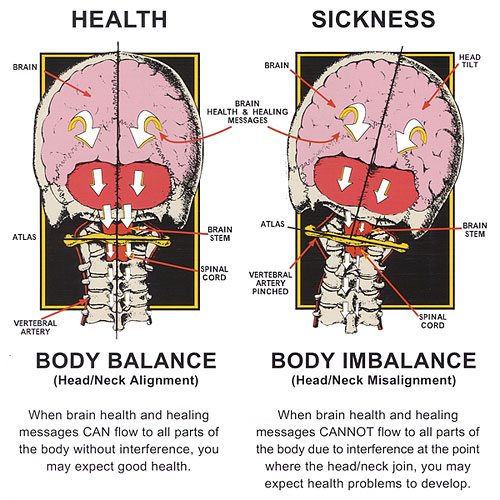 Neck Pain