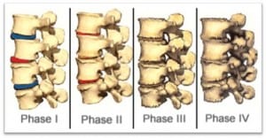chiropractors in austin texas