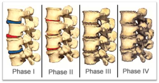 austin-chiropractor-subluxation