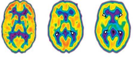 chiropractor in austin texas best austin chiropractor brain function