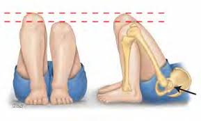 Stretches for sales uneven legs