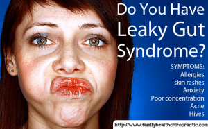leaky-gut-syndrome | Family Health Chiropractic