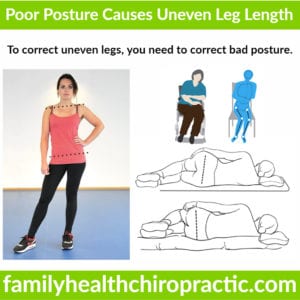 poor posture causes uneven legs