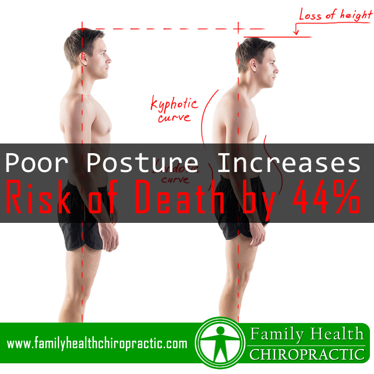 Poor Posture Increases Risk of Death by 44%