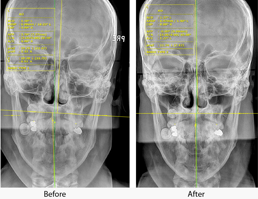 xrays performed by a chiropractor