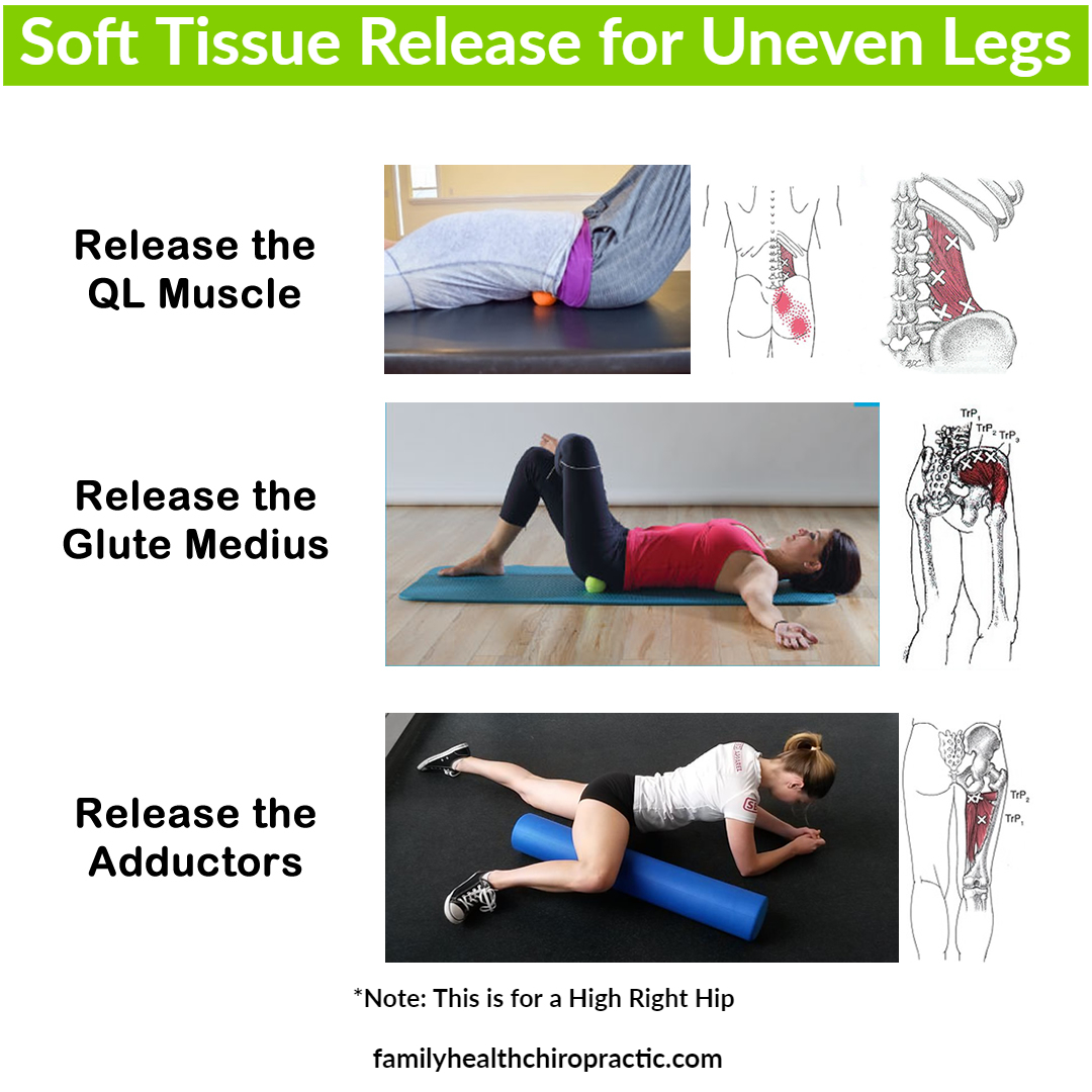 How to Fix A Short Leg Family Health Chiropractic