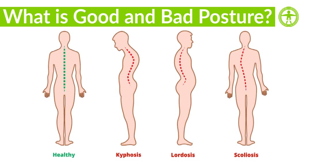 what is good and bad posture